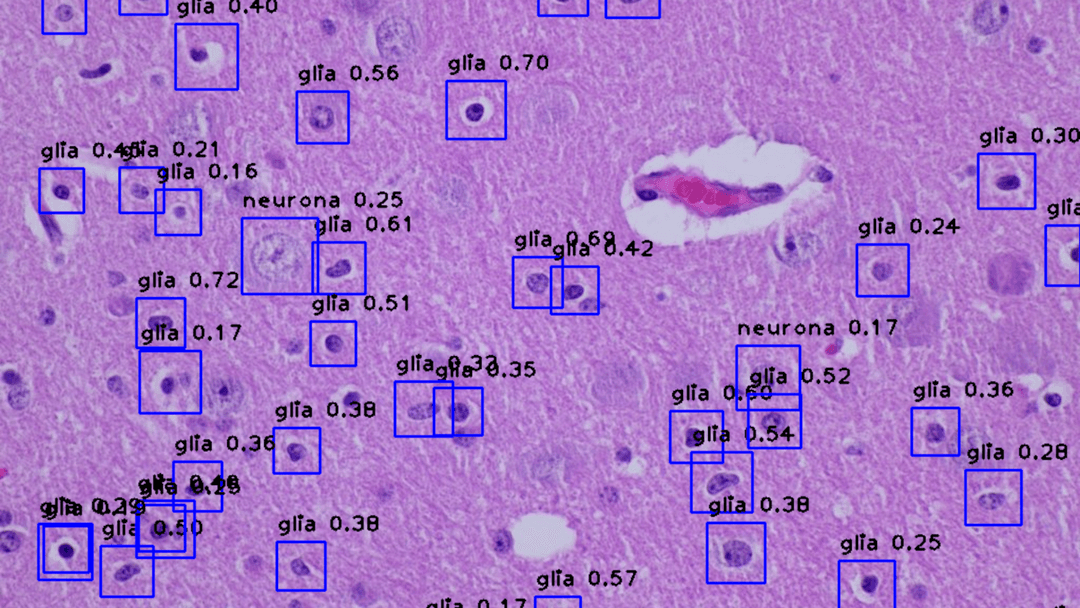 Brain Cells Segmentatation image